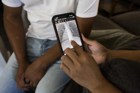 Eleazar Resendiz Cortes’ wife shows scans of his chest that revealed particles around his lungs linked to his silicosis diagnosis, in their home in Bakersfield, California, on May 14, 2026. (Julie Leopo for KQED)