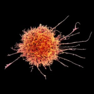 Microscopic view of a natural killer cell with spindly protrusions against a black background, representing a solid tumor within a multimodal framework.
