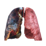 lungs