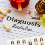 Diagnoses mesothelioma graphic