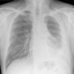 chest x-ray