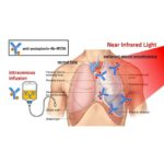 Diagram showing targeted phototherapy using near-infrared light for malignant pleural disease.