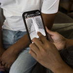A person points at a chest X-ray displayed on a smartphone while sitting next to someone wearing jeans and a white shirt, possibly discussing crystalline silica exposure related to artificial stone and the recent California ban.