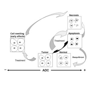Flowchart showing cell responses to treatment: cell swelling, paths to tumor or normal, necrosis, apoptosis, with arrows indicating movement between these states. An ADC axis at the bottom ranges from negative to positive, demonstrating how advanced MRI technology aids in cancer detection and treatment monitoring.