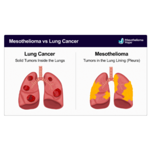 Illustration comparing lung cancer (left, red tumors inside lungs) and mesothelioma (right, yellow tumors in lung lining/pleura). Text explains tumor locations and highlights resistance mechanisms. Header: Mesothelioma vs Lung Cancer.