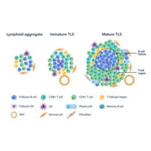 Diagram showing the progression from lymphoid aggregate to immature and mature tertiary lymphoid structures in mesothelioma, with labeled immune and stromal cells in various colors forming increasingly complex arrangements.